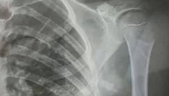 赤峰市教育局介入,家长称:孩子拨弄开关被另一班班主任打伤