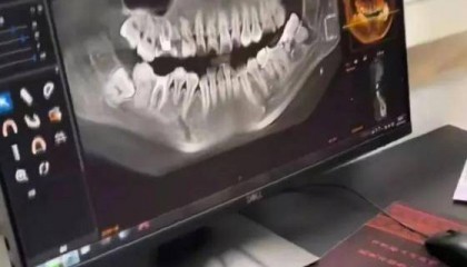 女子疑因被拔错牙坠楼后续:家属与相关方已达成协商