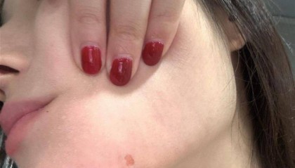 女生在上海禁烟场所被烟头烫伤,绝不能被视为“个人纠纷”